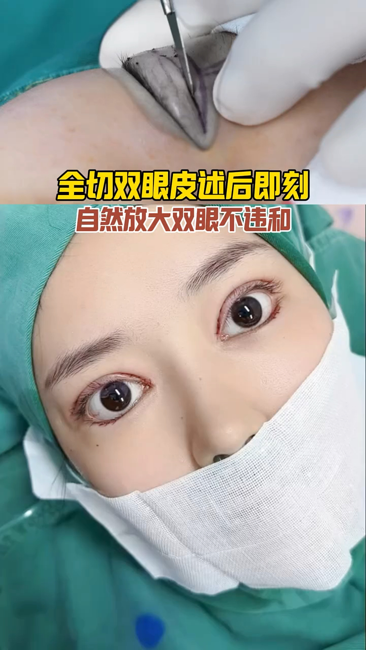 文章插图